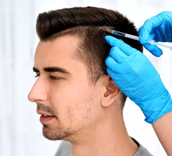 Sedierte Haartransplantations Methode