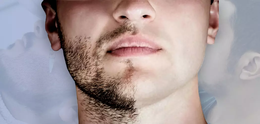 Greffe de barbe